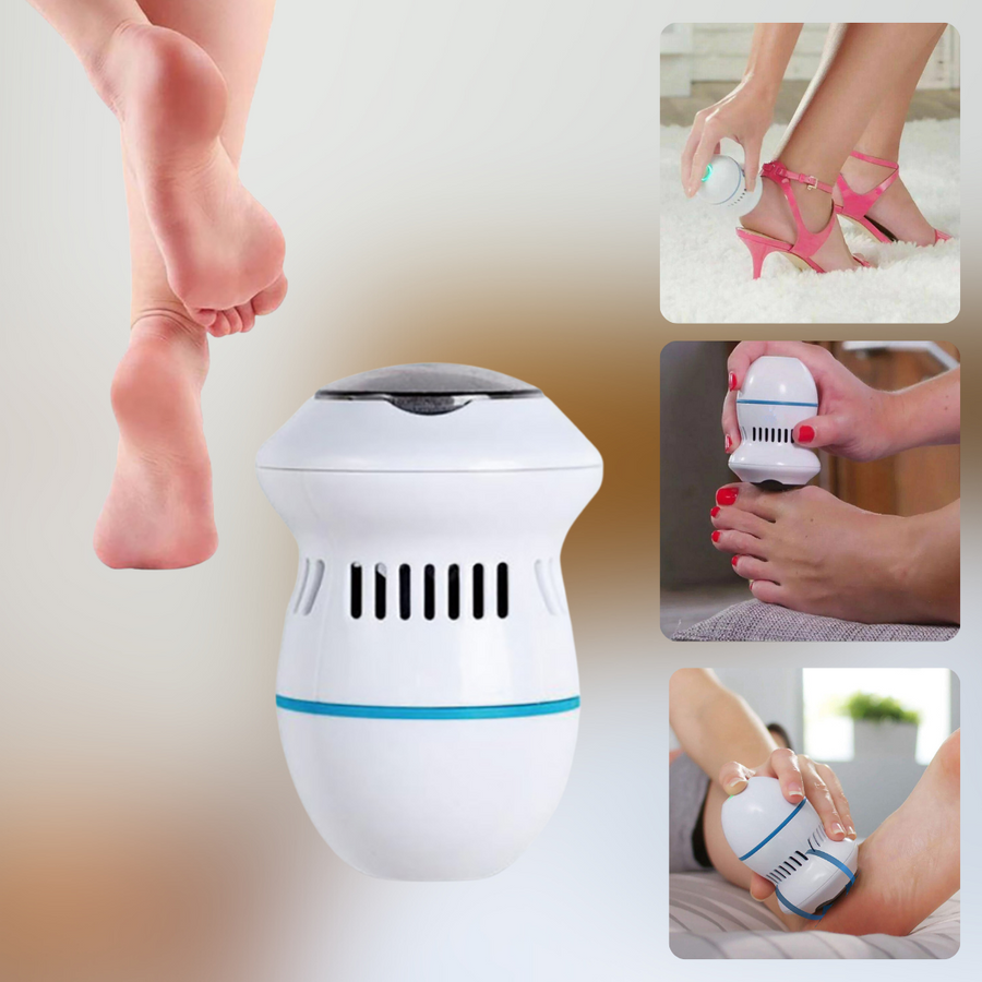 Smart Callus Remover